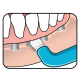 Escova TePe Compact Tuft Escova TePe Compact Tuft