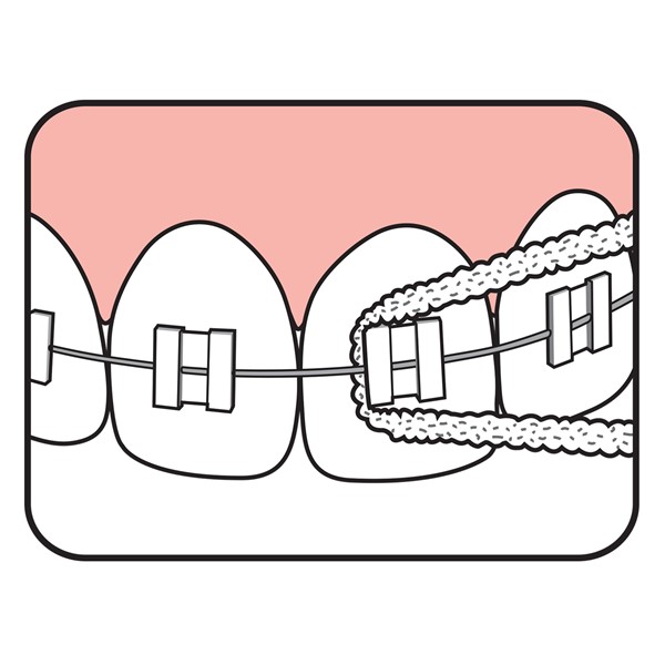 Fio dentário Pontes & Implantes TePe Fio dentário Pontes & Implantes TePe