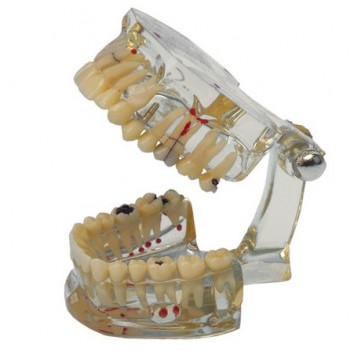 Modelo Study Transparent Modelo Study Transparent