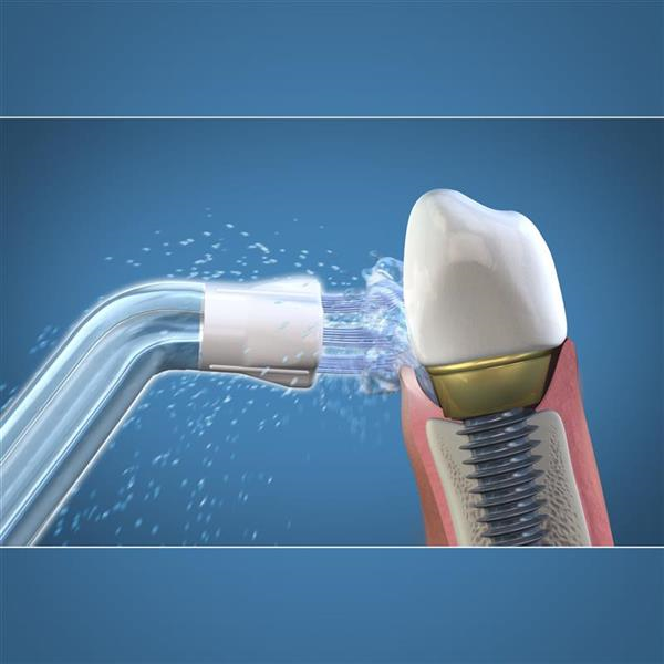 Pontas/Recargas Plaque Seeker Waterpik Pontas/Recargas Plaque Seeker Waterpik